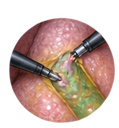 anatomia vescicula en Merida