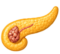PANCREATITIS